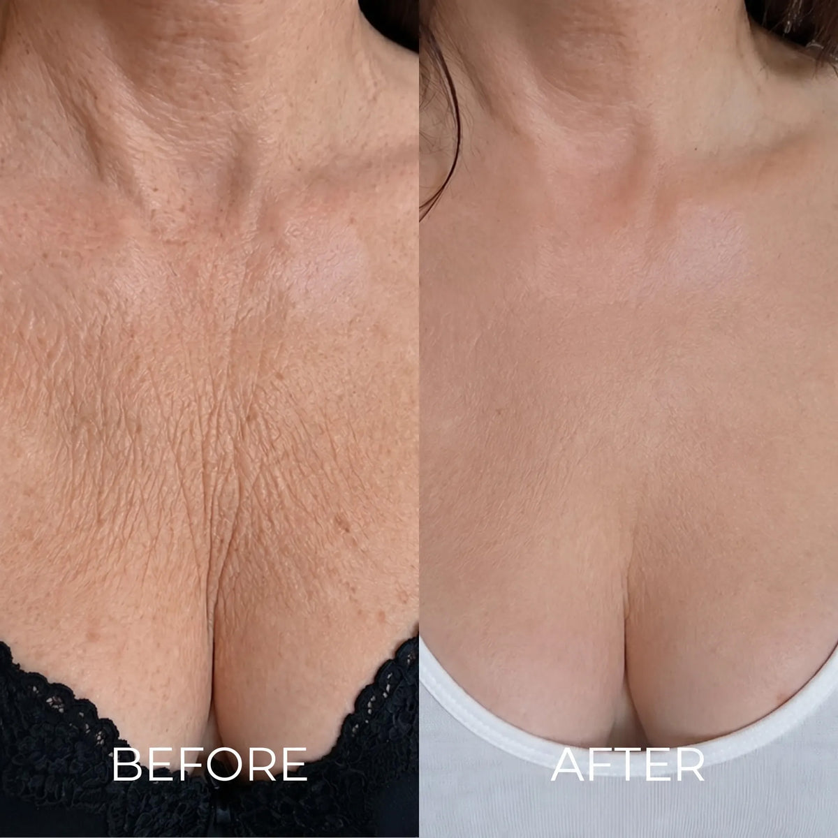 Stop Moisturising. Start Using What Korean Women Have Been Using For Decades