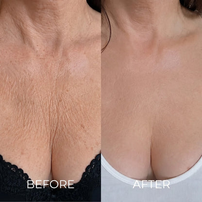 Stop Moisturising. Start Using What Korean Women Have Been Using For Decades